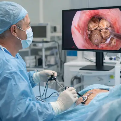 Bladder Stone Surgery in Delhi